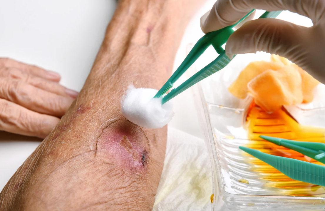 Comprehensive Wound Care